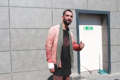 Kurban keserken bıçaklı kendini yaraladı, yaşadıklarını gülerek anlattı