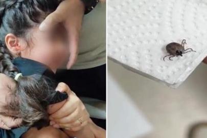 Bir aydır kulak ağrısı çekiyordu! Kulağında canlı kene bulundu