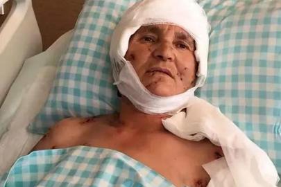 Köpek saldırısında emsal karar! Yargıtay 637 bin liralık tazminatı onadı